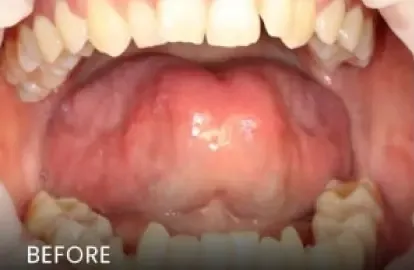 Before: oral condition prior to treatment