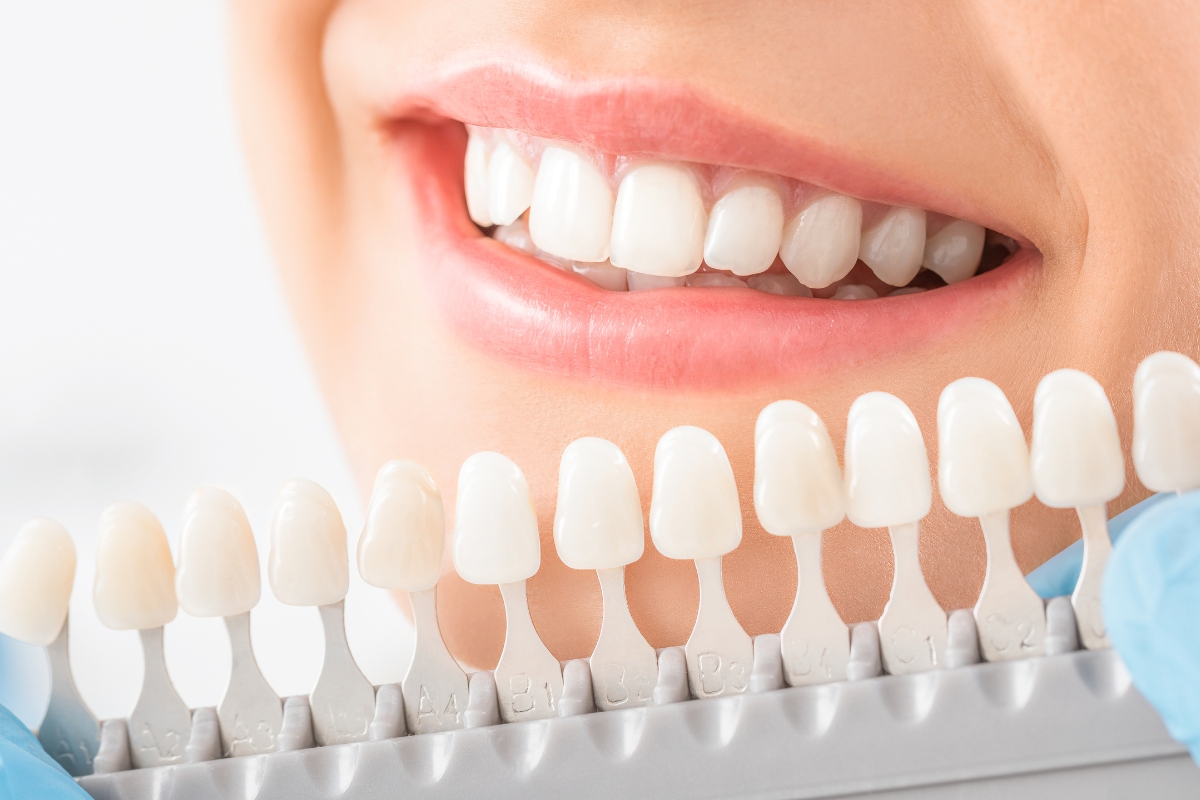 teeth-whitening-in-Cedar-Park
